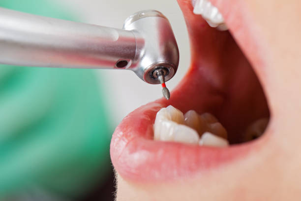 Best Emergency Care for Gum Disease in Montgomery, IN